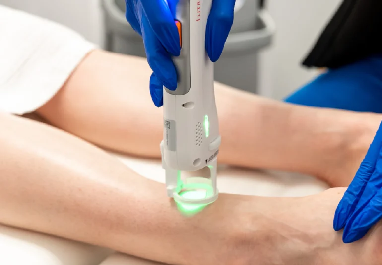 Laser Hair Removal