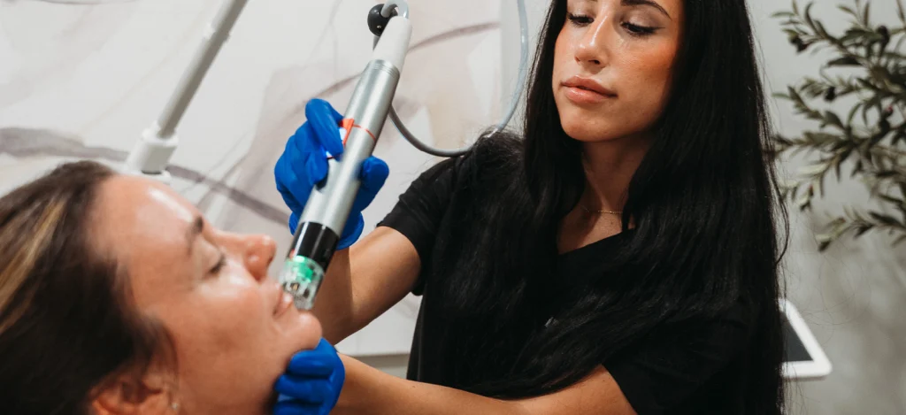 Microneedling