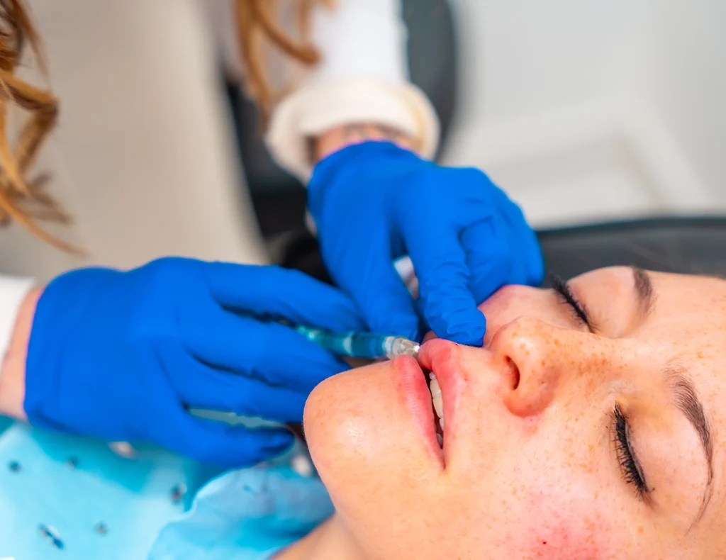 Dermal Fillers