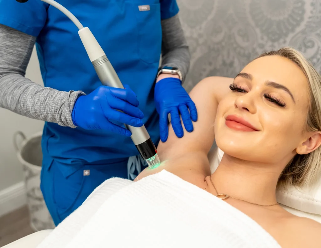 Microneedling