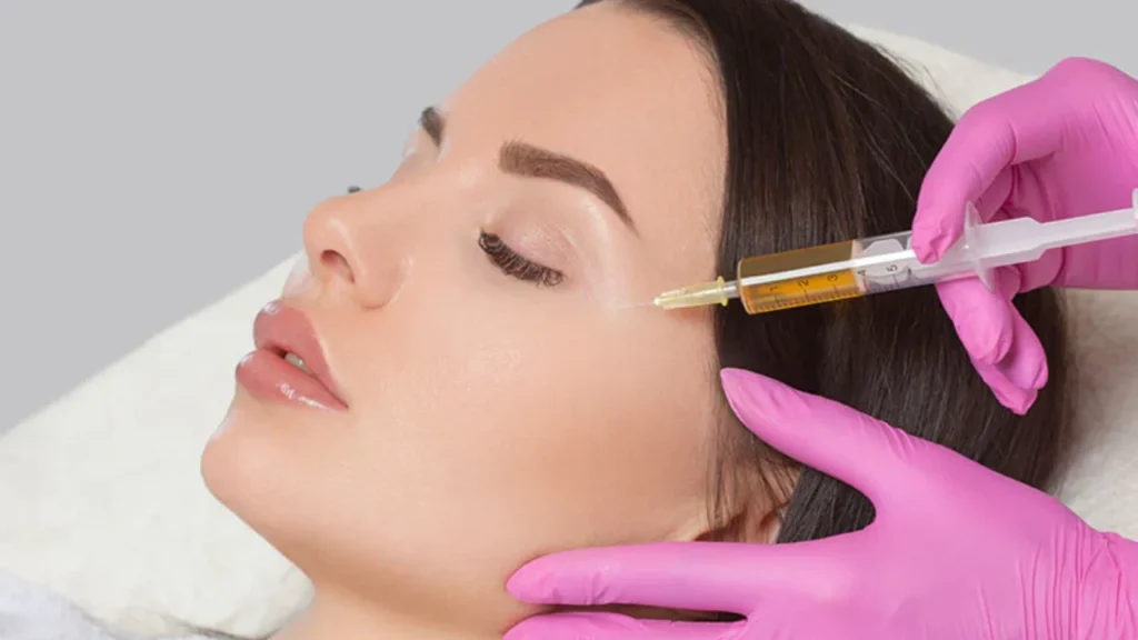 Dermal Fillers