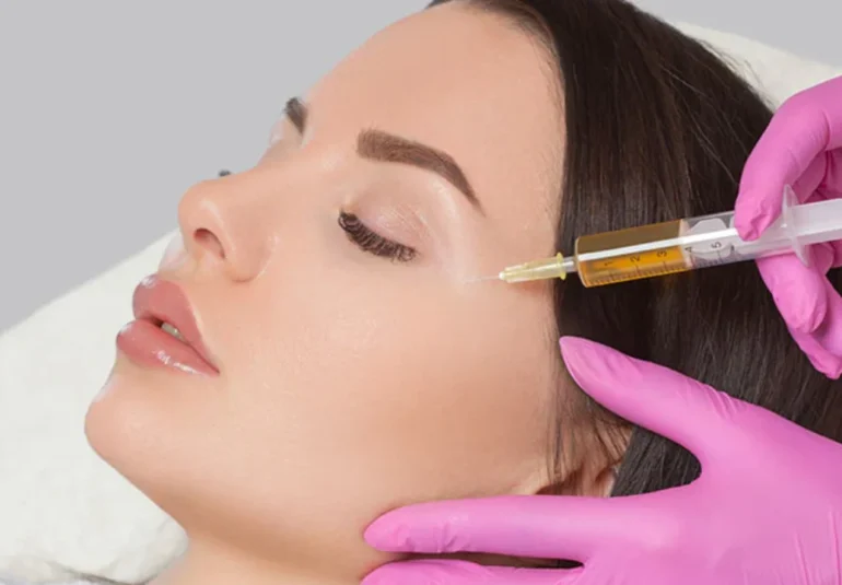 Dermal Fillers